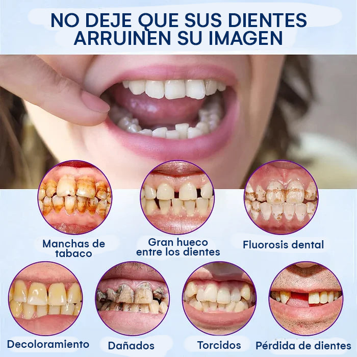 DentureSet Pro | Set Completo de Dentaduras