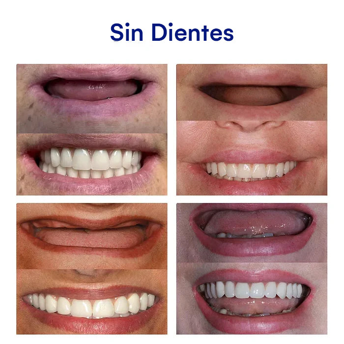 DentureSet Pro | Set Completo de Dentaduras
