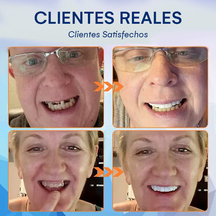 DentureSet Pro | Set Completo de Dentaduras