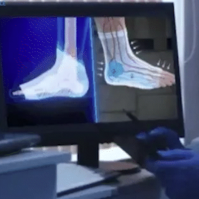 Calcetines FlexiSana™ – Tecnología De Compresión Para Aliviar Pies Adoloridos Y Tensos